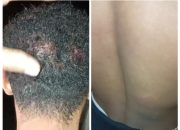 Operasi Satgas di Raihat Diduga Brutal, Warga Babak Belur dan Nenek Ditodong Pistol