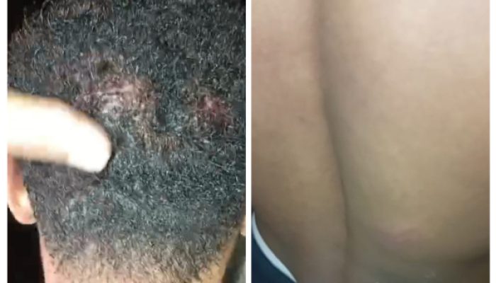 Operasi Satgas di Raihat Diduga Brutal, Warga Babak Belur dan Nenek Ditodong Pistol