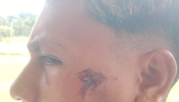 Kasus Pemukulan di Weain, Korban Soroti Transparansi Penanganan oleh Polsek Rinhat