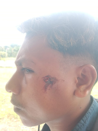 Kasus Pemukulan di Weain, Korban Soroti Transparansi Penanganan oleh Polsek Rinhat